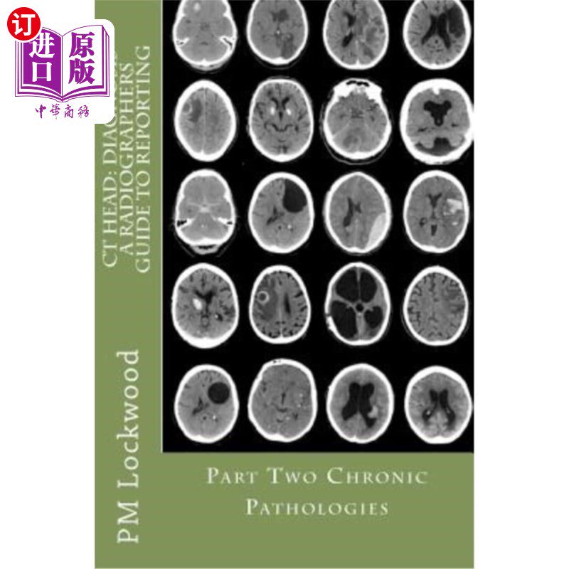 海外直订医药图书CT Head: DIAGNOSIS A Radiographers Guide To Reporting Part 2 Chronic Pathologies CT头部：诊断放射技