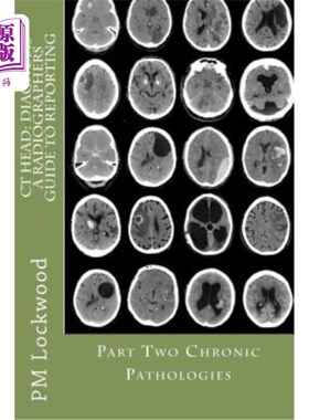 海外直订医药图书CT Head: DIAGNOSIS A Radiographers Guide To Reporting Part 2 Chronic Pathologies CT头部：诊断放射技