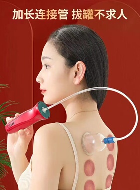 鑫德丰厂家电动拔罐器多功能