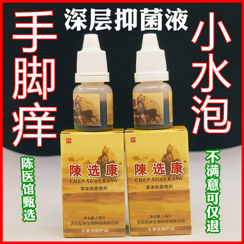 手掌手上起小水泡手指痒有长小水泡止.痒液汗泡汗状汗疱抑菌乳膏