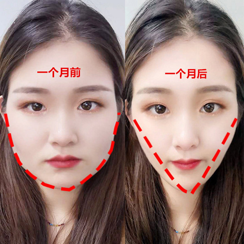 【李佳琪推荐 秒变瓜子脸】小脸神器 大脸不求人 男女通用~
