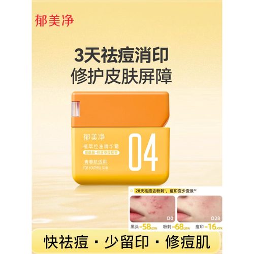 正品郁美净青少年植萃控油精华霜烟酰胺积雪草提祛痘保湿舒缓面霜