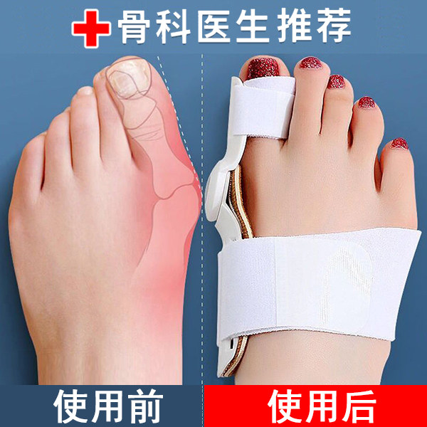 德国脚趾矫正器拇指外翻男女士大母脚趾头足纠正大脚骨突出可穿鞋,居家日用,腿部防护用品,淘宝优惠券,粉丝福利购,淘宝优惠卷