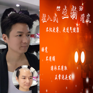 全手织真人发块男款 高端头顶补发发块新递针隐形逼真短增补发