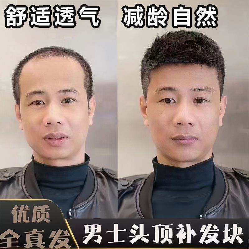 假发男短发毛寸真发无痕隐形假发片自然男士头顶补发片光头发型