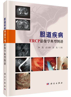 [按需印刷]胆道疾病ERCP影像学典型图谱科学出版社