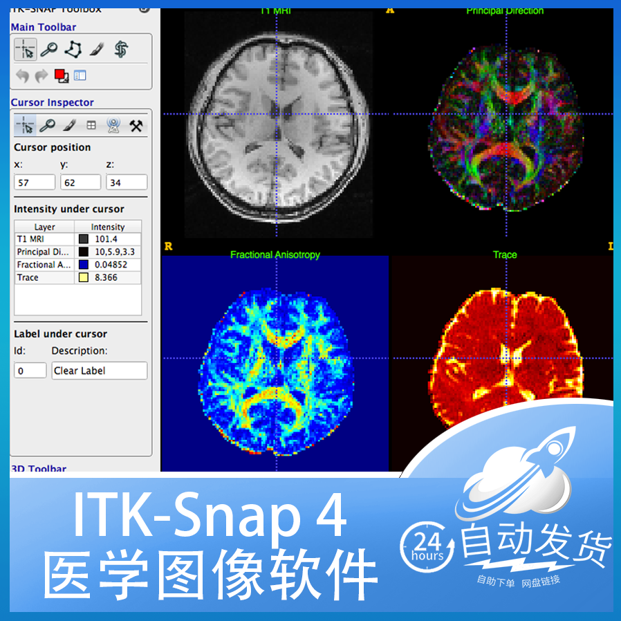 Win Mac  ITK-Snap 4 三维二维医学图像查看编辑切分itksnap软件