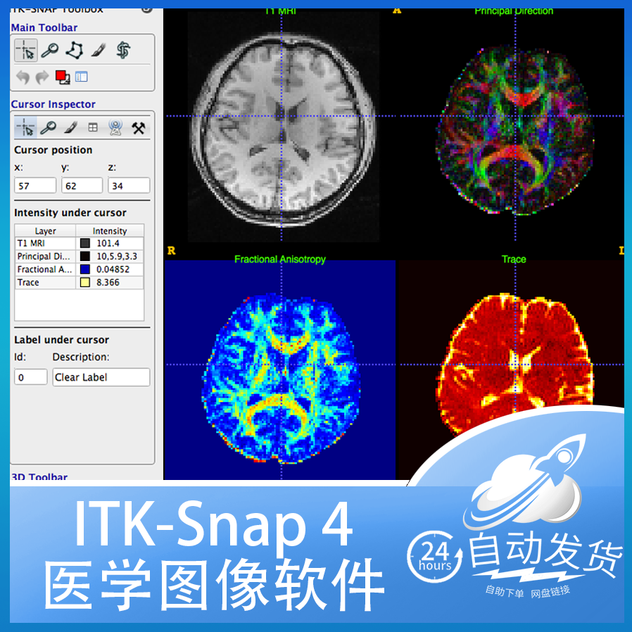 Win Mac ITK-Snap 4三维二维医学图像查看编辑切分itksnap软件