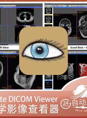 Sante DICOM Viewer Pro 12.2.4 医学影像编辑软件 永久授权
