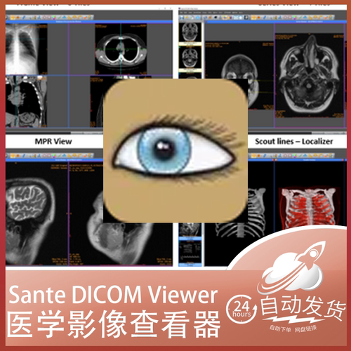 Sante DICOM Viewer Pro 12.2.4 医学影像编辑软件 永久授权