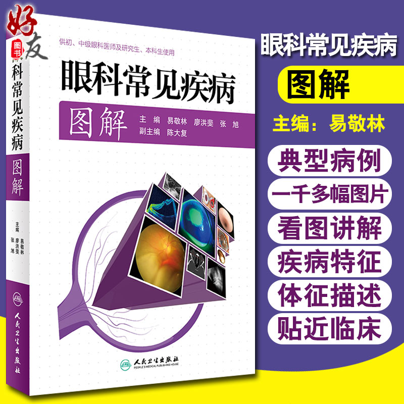 正版 眼科常见疾病图解 易敬林 廖洪斐 张旭主编 供初中级眼科医师及研究所本科生实用书籍 人民卫生出版社 眼科学 眼科临床 角膜
