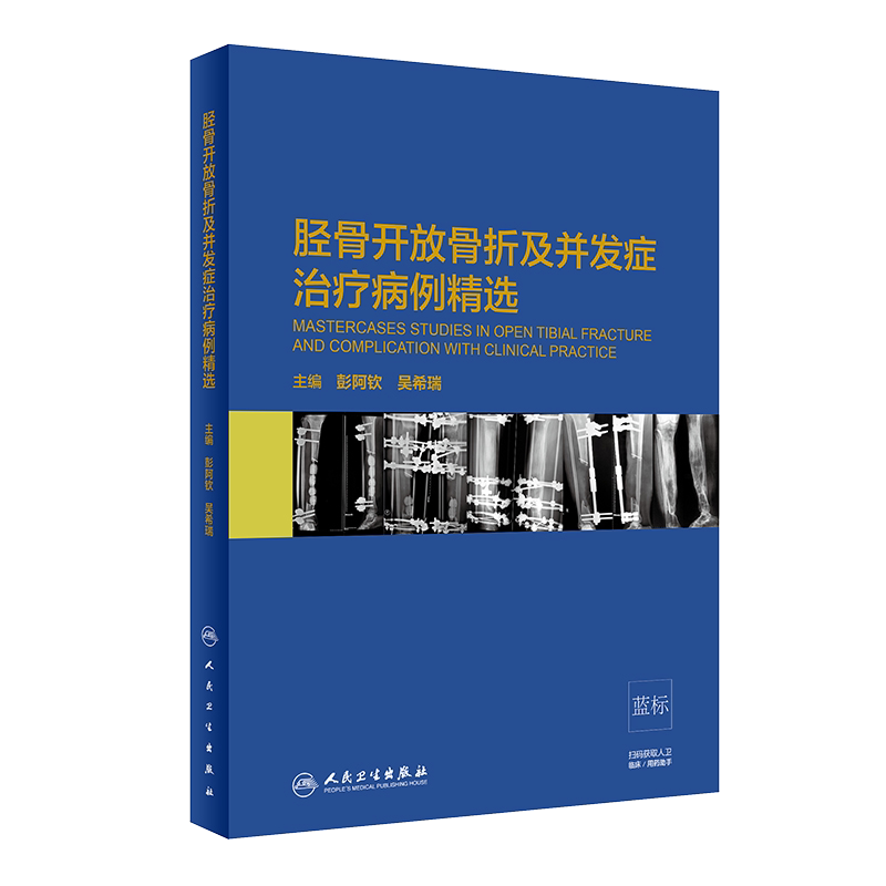 现货速发 胫骨开放骨折及并发症治疗病例精选 医学书籍 彭阿钦 吴希瑞 主编 外科学 人民卫生出版社 9787117287517