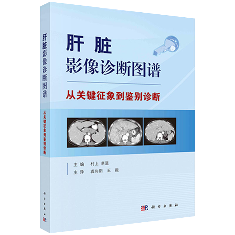 肝脏影像诊断图谱—从关键征象到鉴别诊断 临床影像 阐述了从关键影像表现引导到鉴别诊断的思考过程 村上 卓道主编9787030664815