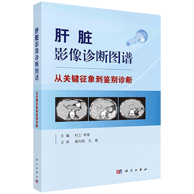 肝脏影像诊断图谱—从关键征象到鉴别诊断 临床影像 阐述了从关键影像表现引导到鉴别诊断的思考过程 村上 卓道主编9787030664815