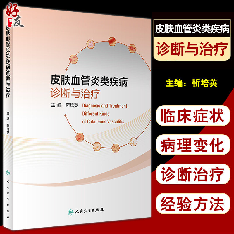 皮肤血管炎疾病诊断治疗