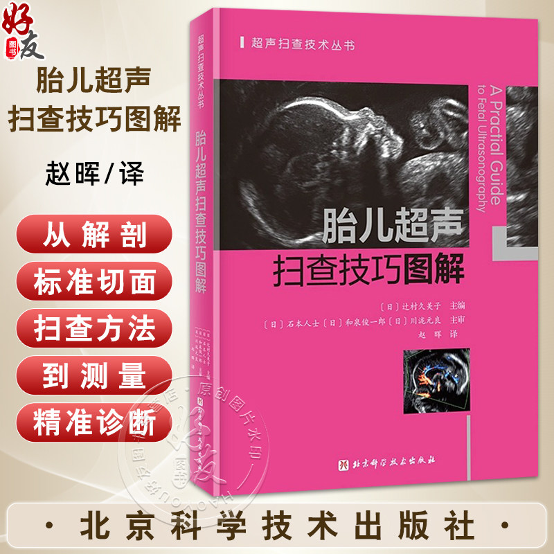 胎儿超声扫查技巧图解 超声扫查技术丛书 赵晖 主译 适用产科超声医生及相关专业人员 9787571442941 北京科学技术出版社