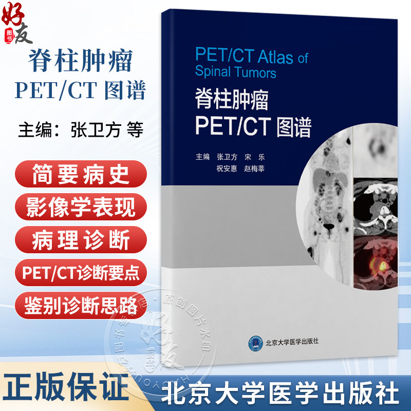 脊柱肿瘤 PETCT 图谱 张卫方 宋乐 祝安惠 赵梅莘 脊髓疾病 神经组织肿瘤 影像诊断 图谱 影像学9787565935190北京大学医学出版社