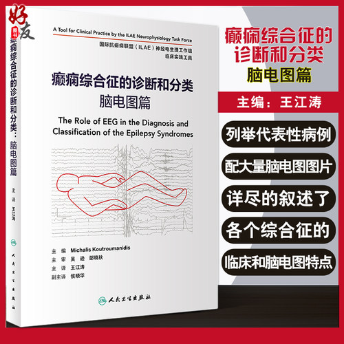 癫痫综合征的诊断和分类