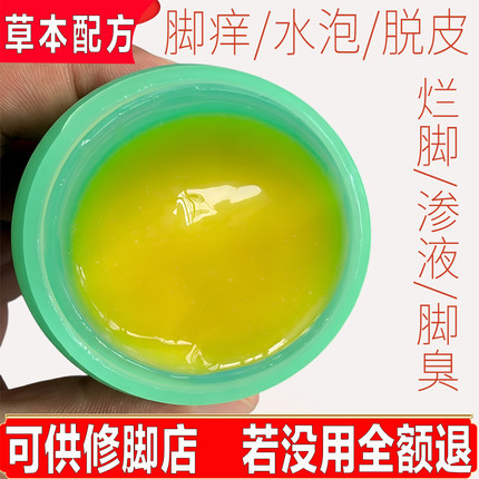 脚上起水泡型乳膏去真菌感染脱皮止痒烂脚丫脚痒脚臭脚趾缝烂专用
