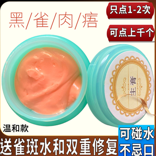 美容院点痣膏去黑点脸部雀斑黑痣点痦子笔神器药水不留疤正品专用