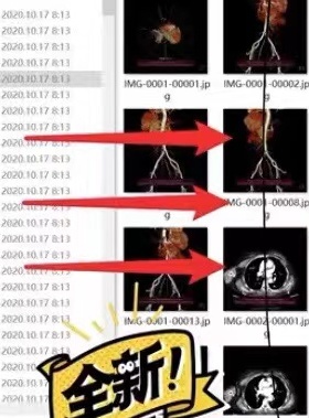 CT影像学数据DICOM格式转换图片格式服务