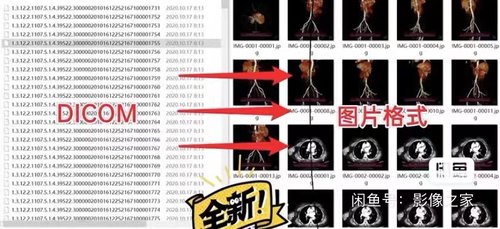 CT影像学数据DICOM格式转换图片格式服务