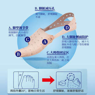分趾 自营 脚趾拇指外翻矫正器大母脚指大脚骨纠正神器可穿鞋