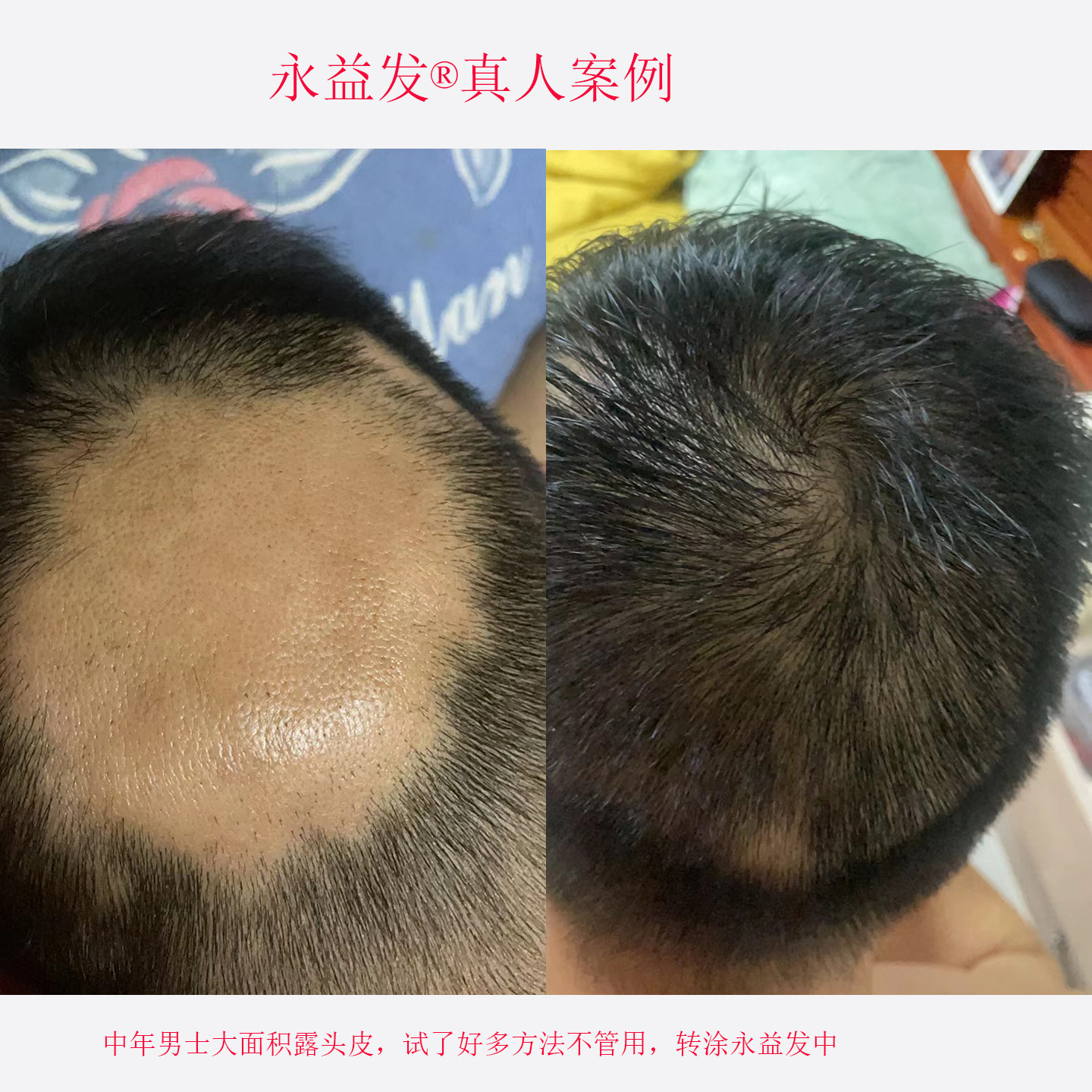 永益发老中医专家密发快不长退图片