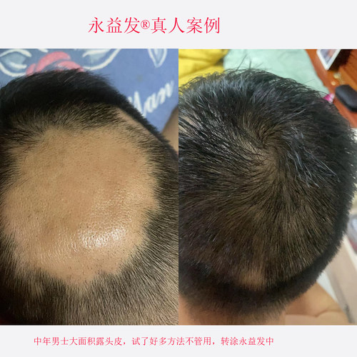 永益发老中医专家密发快不长退