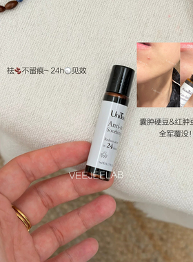 24小时祛豆精华 Untouch优莉缇淡化豆印温和急救壬二酸精华液5ml