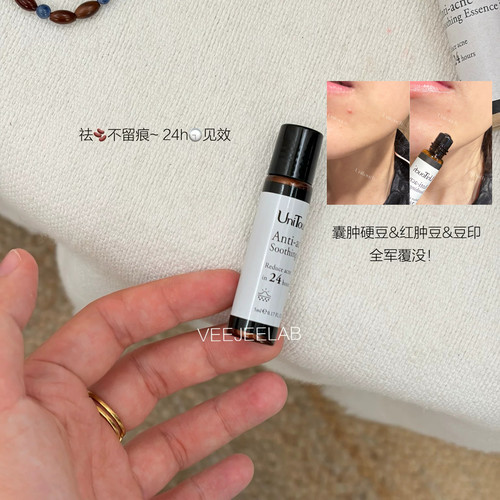 24小时祛豆精华Unitouch温和急救
