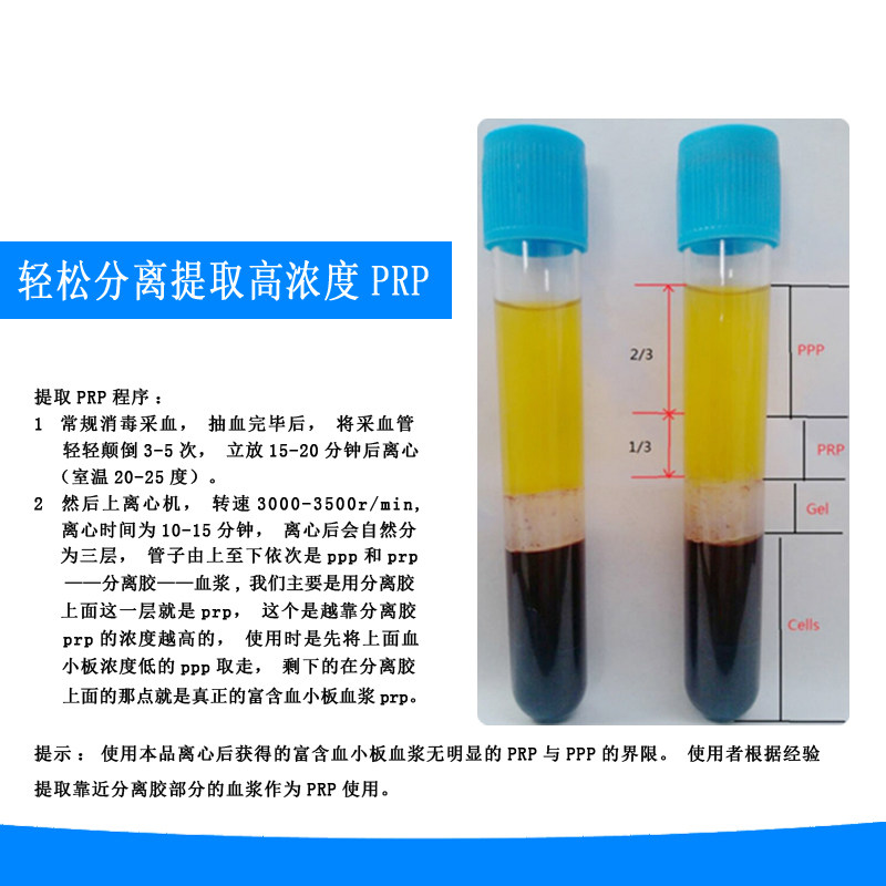 信灵PRP采血管无菌PRP提取管8ml分离胶/柠檬酸钠抗凝剂血清分离管图片