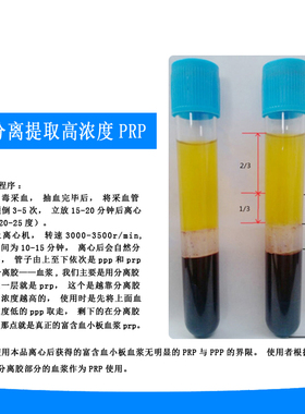 信灵PRP采血管无菌PRP提取管8ml分离胶/柠檬酸钠抗凝剂血清分离管