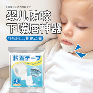 婴儿防咬下嘴唇神器宝宝儿童睡觉戒咬嘴唇矫正贴婴儿防吸下嘴唇