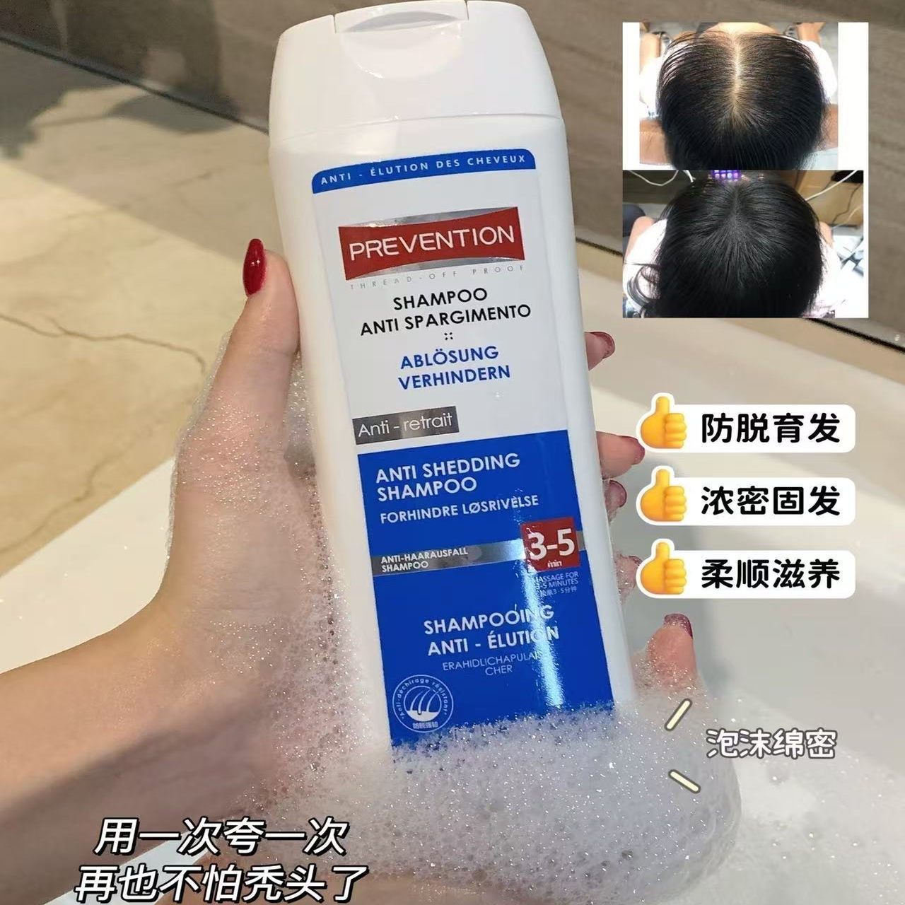 PREVENTION水焕玑德国进口洗发水水防脱控油去屑止痒蓬松育发清洁