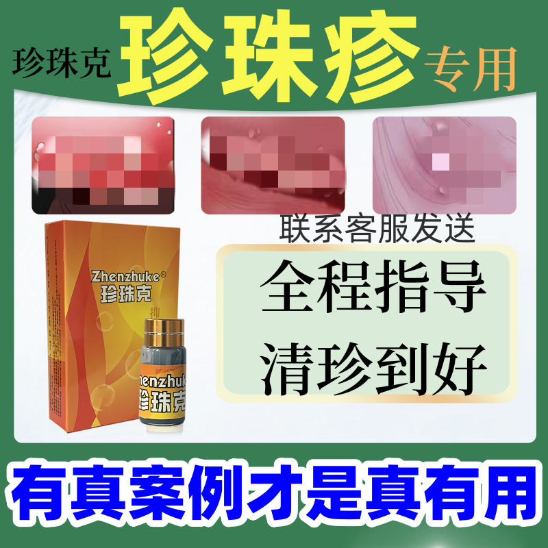 珍珠克冠状沟珍珠粒疹丘疹去除珍珠疹克星龟专用头男士
