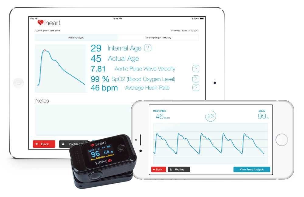 iheart internal age 健康监测器.
