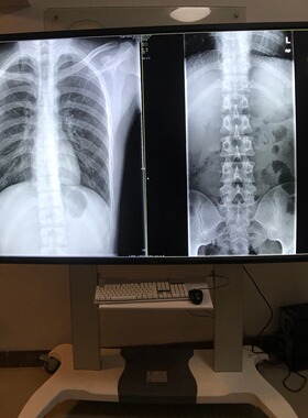 日电 NEC高清大屏4K显示器医疗会诊液晶屏 98寸 M981 M861 86寸