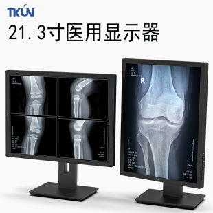 21.3寸3兆灰阶CT核磁X片DR放射诊断DICOM医疗医用显示器TM3G213A