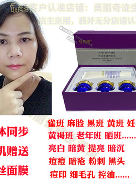 正品美白祛斑霜妊娠遗传