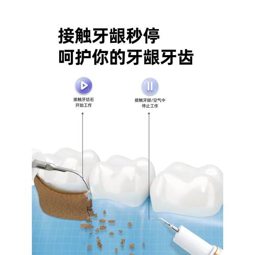 高档趣声健乐牙器超波洁牙器去除牙石牙垢冲器牙家用洗牙器洁牙齿
