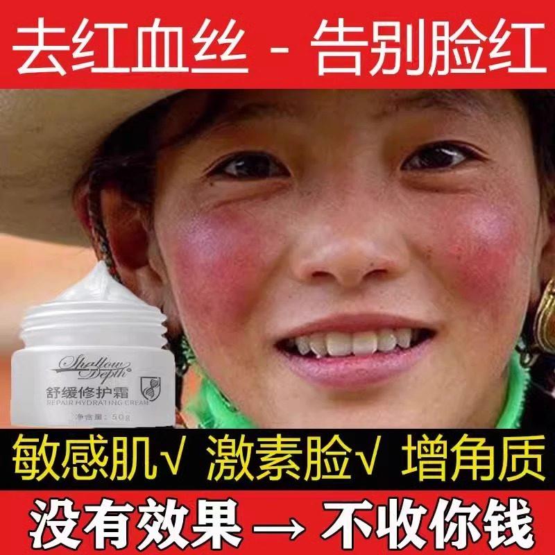 脸红去红血丝增厚角质层祛高原红脸蛋改善敏感肌肤专用护肤品
