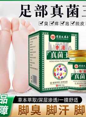 珍香港真菌王痒WTS皮肤瘙痒湿皮焱荨膏麻牛皮手足止脱皮水泡抑菌