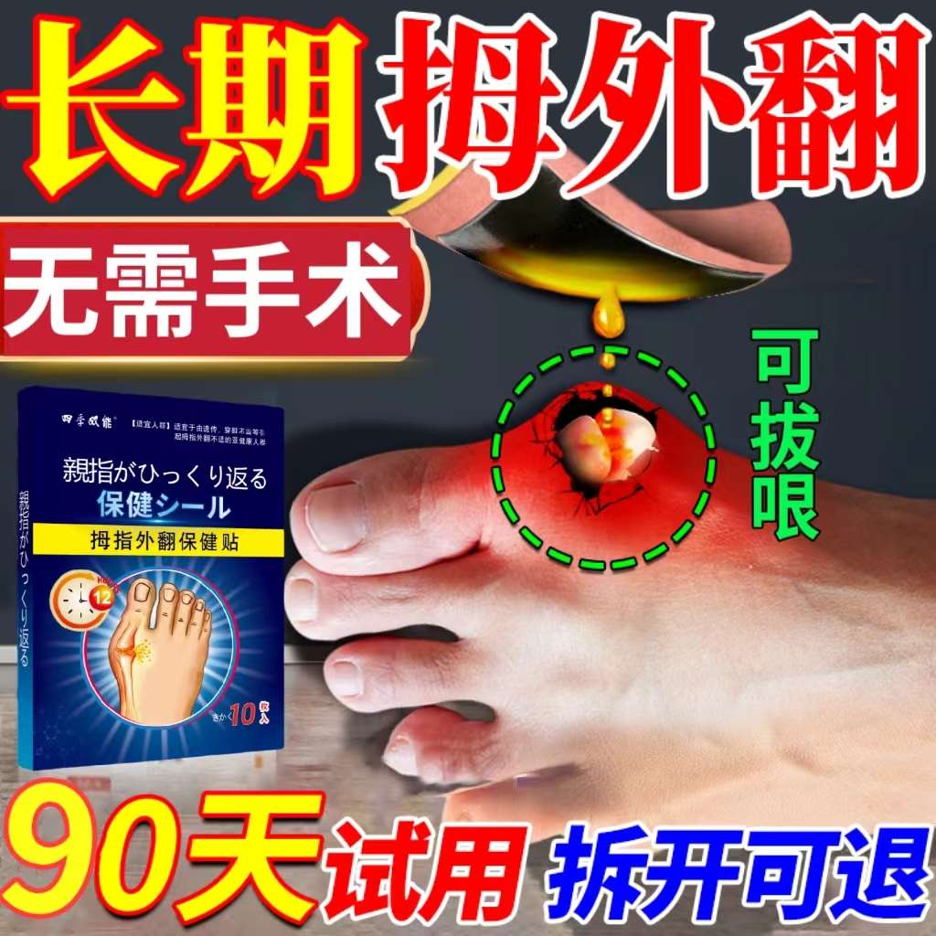 大脚外翻拇指用药外翻拇矫正专贴重叠大贴趾药膏脚骨拇矫正器外翻
