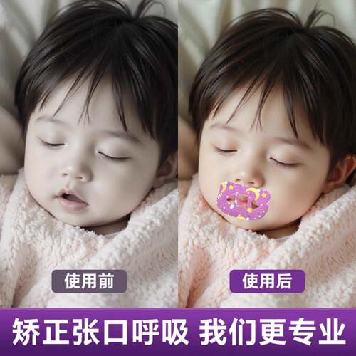 防止嘴巴闭口呼吸矫正器封嘴封口唇贴闭嘴止鼾睡觉防张嘴睡眠儿童