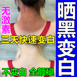 晒黑了皮肤晒伤儿童军训晒后修复霜快速变白身体(白身体)乳脸脖子美白专用