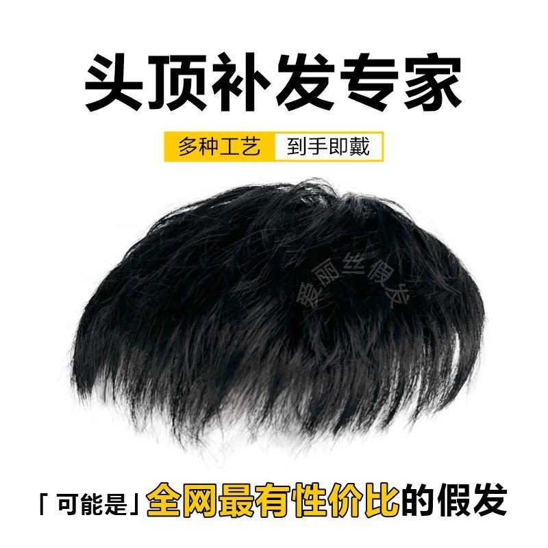 男士假发短发帅气隐形头顶补发块遮白发地中海秃头男式轻薄补发片