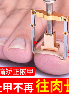 矫正器专用专用趾甲趾甲美甲工具