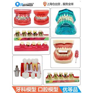 牙齿模型 牙科标准牙模 牙模型 教学假牙带神经医患沟通 口腔模型