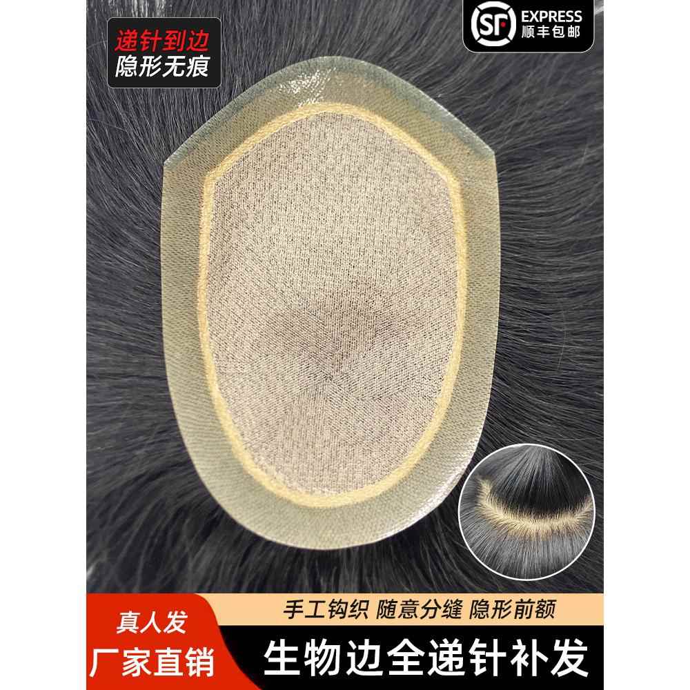 男士假发头顶补发男短递针真发补发块前额发际线隐形无痕生物头皮